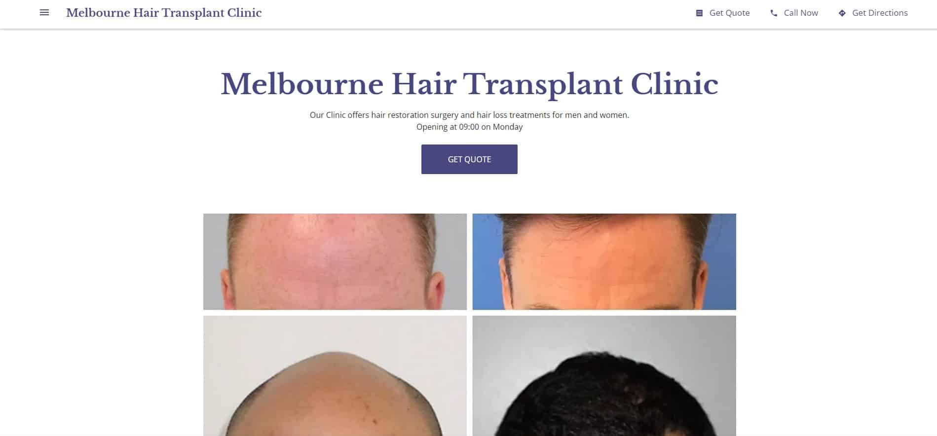 melbourne hair transplant clinic